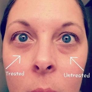 IdealEyes caffeine eye cream